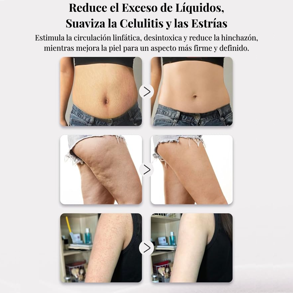 Masajeador de Drenaje Linfático